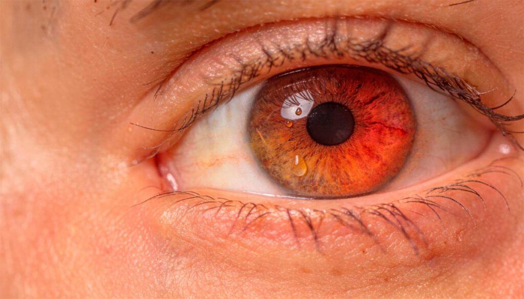 Guía médica completa de la Dra. Vanessa Vidal sobre el Síndrome de Ojo Seco y la lubricación ocular. Entienda las causas, la importancia de los párpados y los tratamientos de vanguardia para su visión