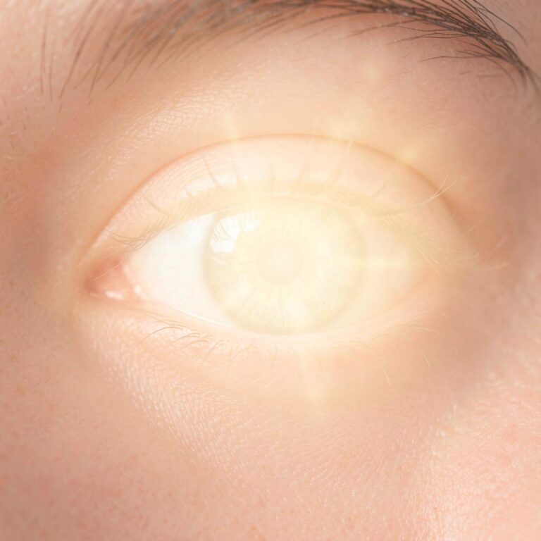 LASIK vs PRK: diferencias, ventajas y cuál puede ser mejor para ti